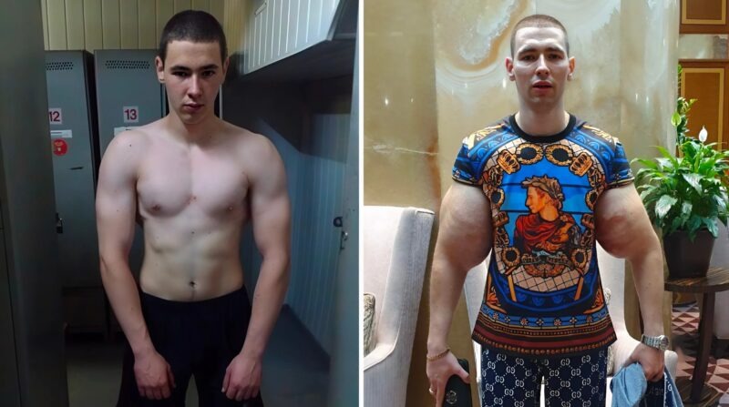 He Turned Heads with Massive Arms—Then Changed His Face Completely ...